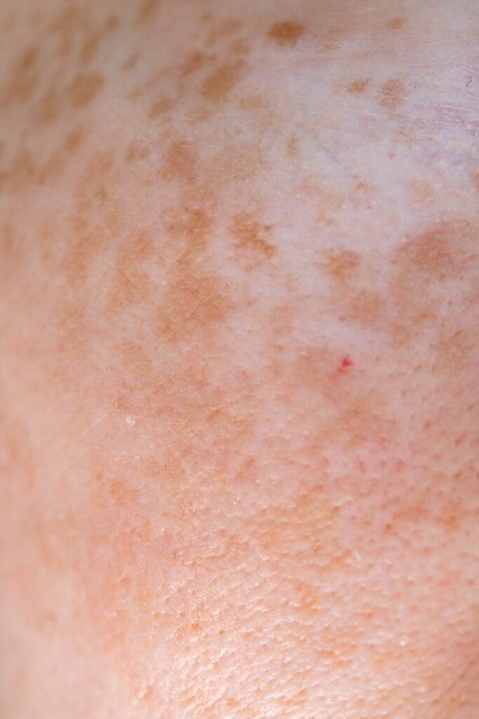 Extreme close-up of freckled Caucasian skin displaying texture and natural pigmentation.